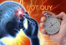 National Stroke Week: Sau tuổi 40, vì sao bạn cần quan tâm đến đột quỵ?