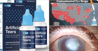 Thêm 2 tử vong, mù mắt liên quan đến thuốc nhỏ mắt bị thu hồi