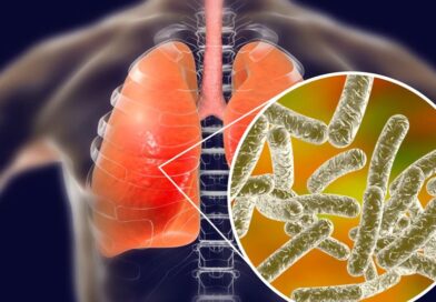 Cảnh báo bùng phát bệnh Legionnaires được phát hiện ở đông nam Melbourne