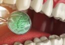 4 cách tự nhiên để ngăn ngừa vi khuẩn gây sâu răng