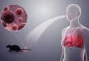 Triệu chứng nhiễm virus Hanta dễ nhầm với các bệnh khác, làm gì để phòng ngừa?