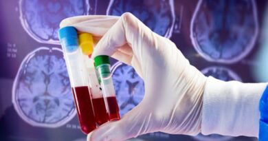 Úc: Phương pháp mới giúp phát hiện sớm bệnh Alzheimer chỉ trong 18 phút