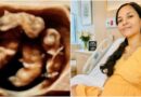 Người mẹ Úc sinh 4 bé gái cùng trứng tự nhiên, xác suất chỉ 1/15 triệu