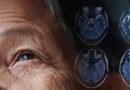 Nghiên cứu Úc: Hy vọng mới trong điều trị Parkinson với liệu pháp tế bào gốc chỉnh sửa gene Nghiên cứu Úc: Hy vọng mới trong điều trị Parkinson với liệu pháp tế bào gốc chỉnh sửa gene