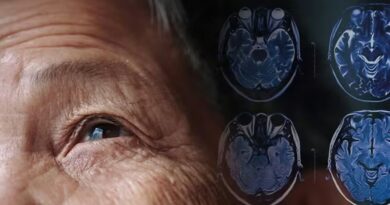 Nghiên cứu Úc: Hy vọng mới trong điều trị Parkinson với liệu pháp tế bào gốc chỉnh sửa gene Nghiên cứu Úc: Hy vọng mới trong điều trị Parkinson với liệu pháp tế bào gốc chỉnh sửa gene