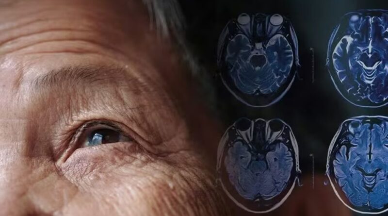 Nghiên cứu Úc: Hy vọng mới trong điều trị Parkinson với liệu pháp tế bào gốc chỉnh sửa gene Nghiên cứu Úc: Hy vọng mới trong điều trị Parkinson với liệu pháp tế bào gốc chỉnh sửa gene