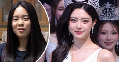 After being crowned Miss Korea 2026, old photos of her surfaced, sparking rumors of plastic surgery After being crowned Miss Korea 2026, old photos of her surfaced, sparking rumors of plastic surgery